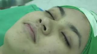 Silicone Rhinoplasty