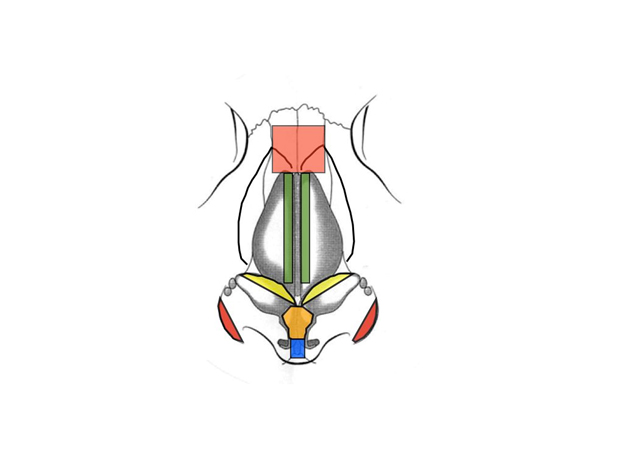 Intraoperative Photo