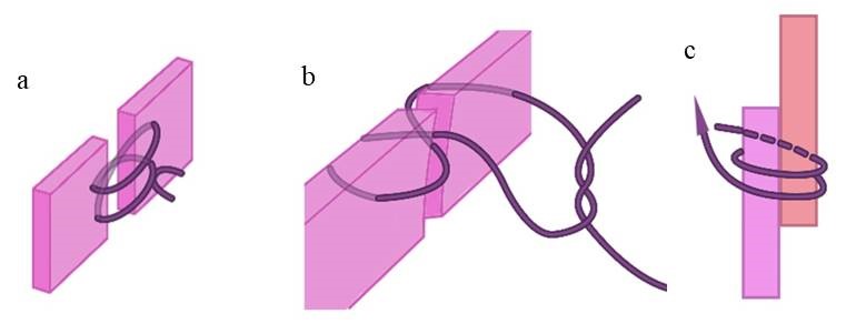 Figure 6. End to end vertical figure of eight locking suture by Hyunsoo, et al. (a) End to end vertical figure of eight locking suture by Byard (b) Overlapping septal extension graft (c)