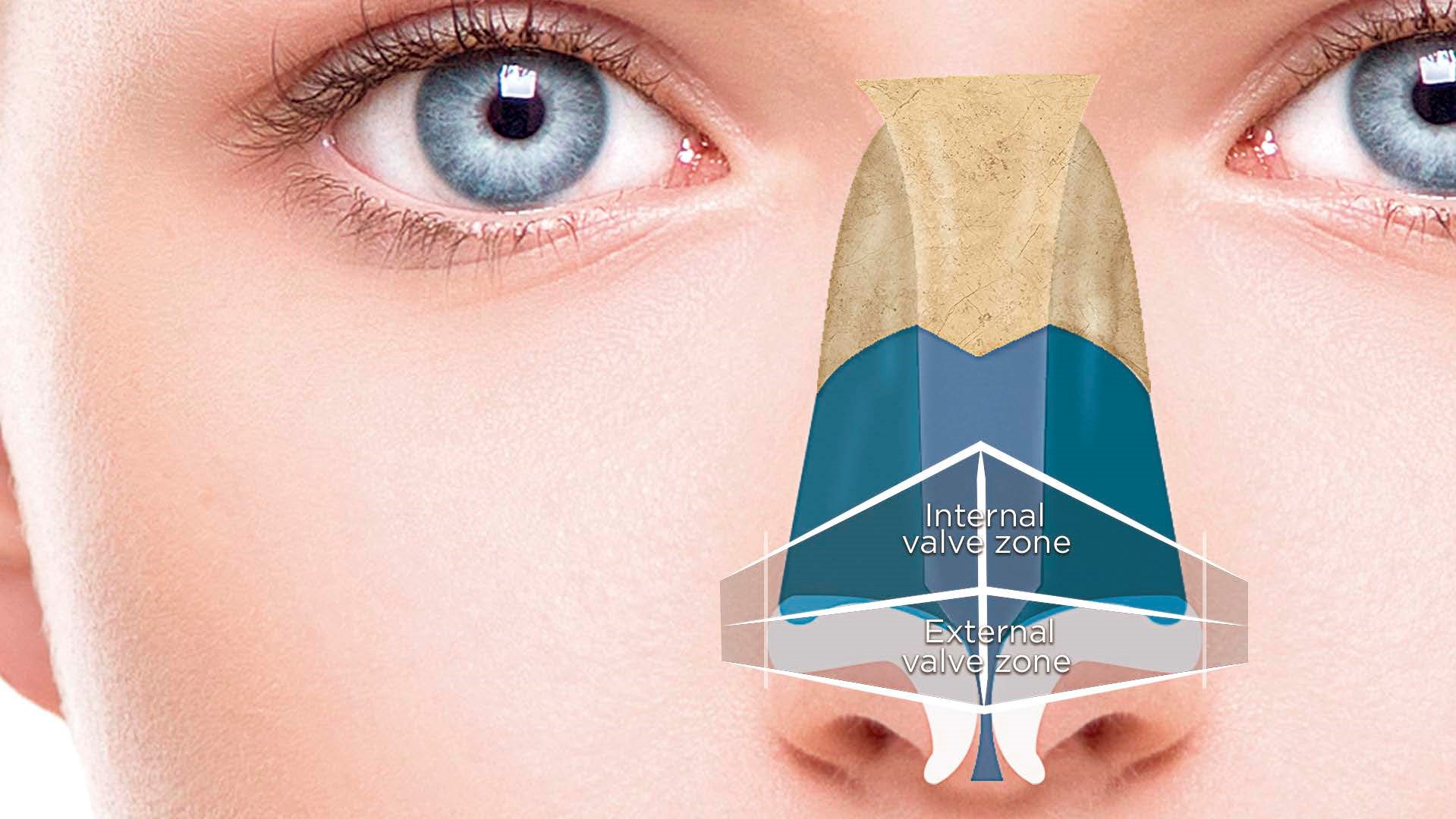 Management of the Internal Nasal Valve Rhinoplasty Archive