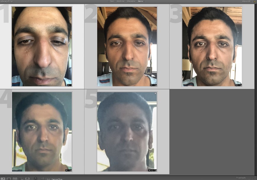 Figure 14: Face perspective distortion - In image #1, the camera was at very close range to the face, and in each subsequent image, the subject was further from the camera.