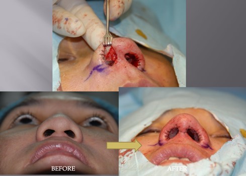 Figure 9b. Before and immediately after defatting