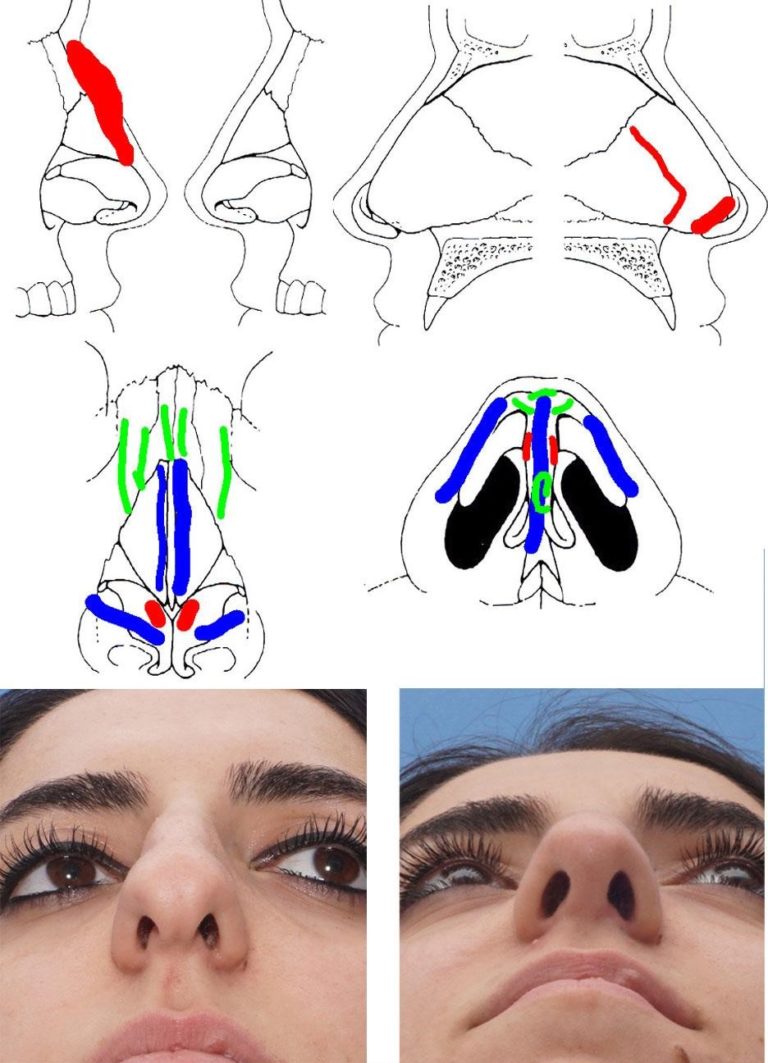 Seeing through the Envelope: The Cartilage Shape Requirements for an ...