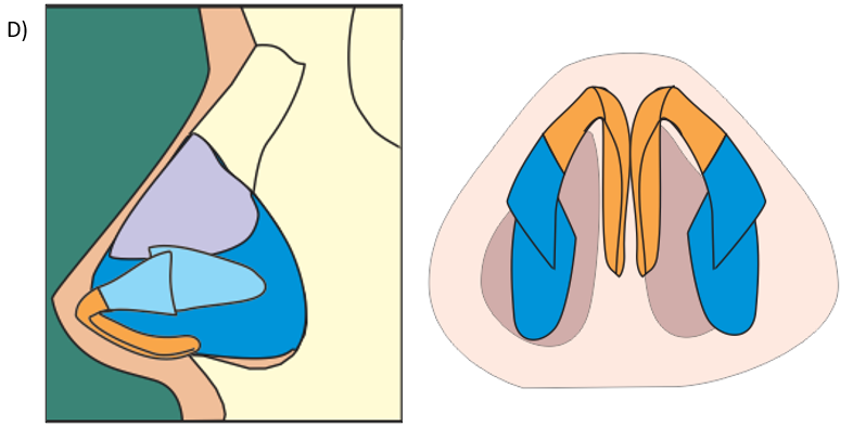 Overprojected Nasal Tip: Technique To Decrease The Nasal Tip Projection ...