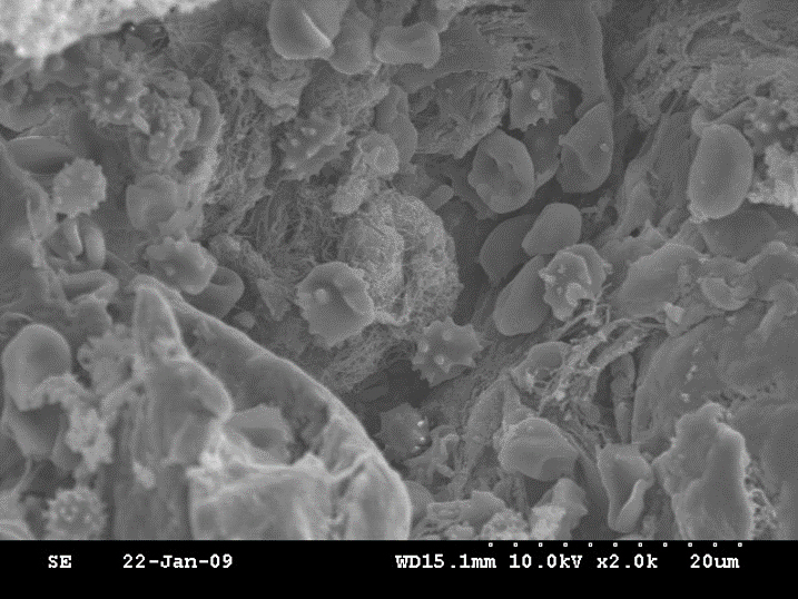 Figure 1. Scanning electron microscope image of an ePTFE implant removed from a patient