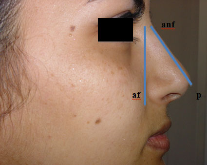 Distance from (af-p) should be approximately 55 to 60% of the distance