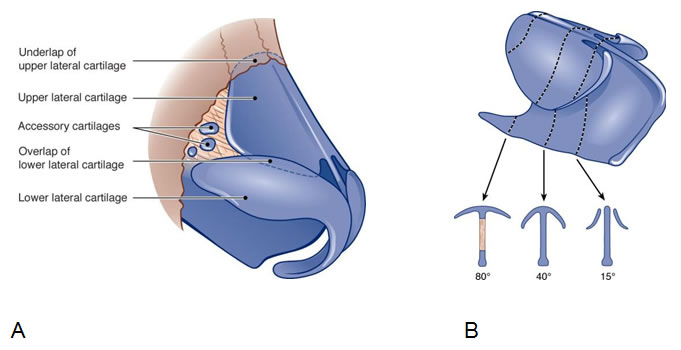 The middle vault represents the middle third of the nose consisting anatomically