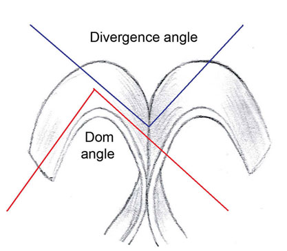 Divergence Angle
