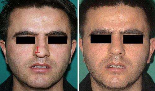 Case example before after photos 1