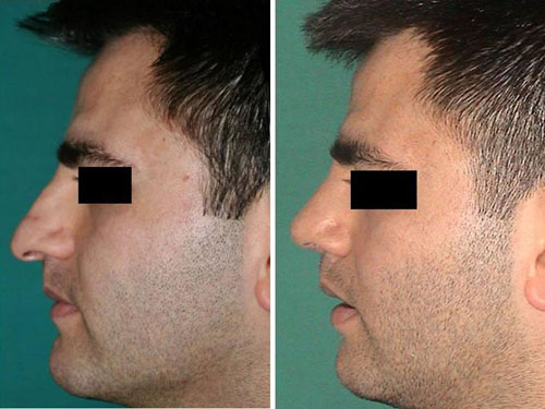 Case example before after photos 2