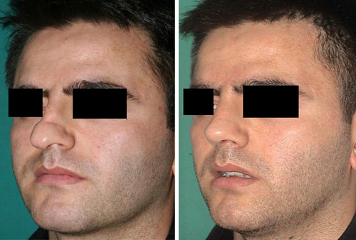 Case example before after photos 3