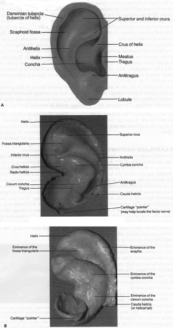 Auricular Cartilage in Revision Rhinoplasty