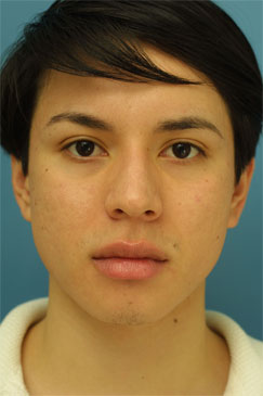 Evaluating the pre-operative photographs 1