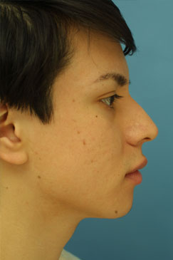 Evaluating the pre-operative photographs 2