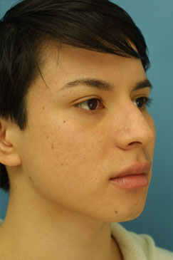 Evaluating the pre-operative photographs 3