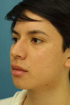 Evaluating the pre-operative photographs 4