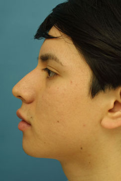 Evaluating the pre-operative photographs 5