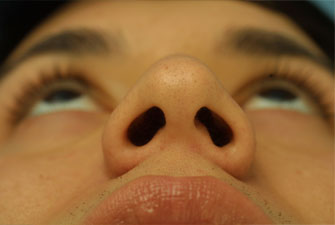 Evaluating the pre-operative photographs 6