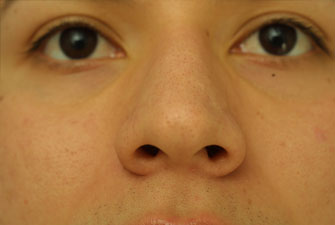 Evaluating the pre-operative photographs 7