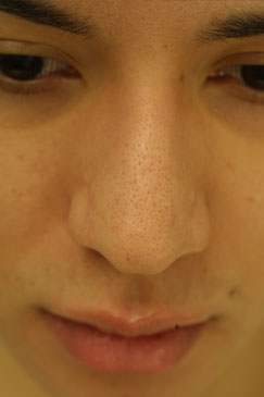 Evaluating the pre-operative photographs 8