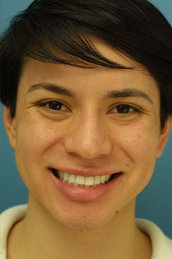 Evaluating the pre-operative photographs 9