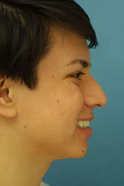 Evaluating the pre-operative photographs 10