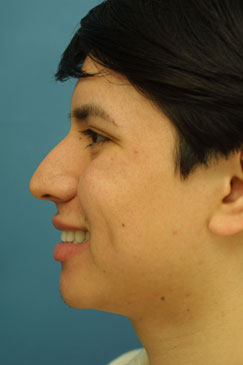 Evaluating the pre-operative photographs 11