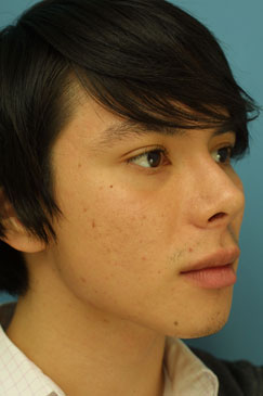 Post-operative Follow-up 3