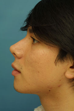 Post-operative Follow-up 5