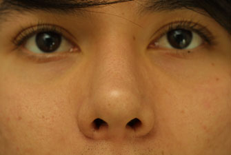 Post-operative Follow-up 7