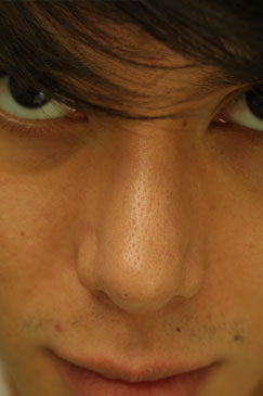 Post-operative Follow-up 8