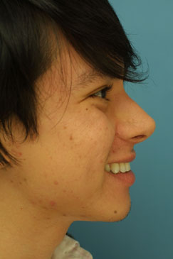 Post-operative Follow-up 10