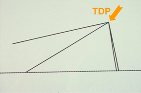 Tripod theory: the conjoined medial crura form one leg of the tripod while the lateral crura represent the other two legs of the tripod