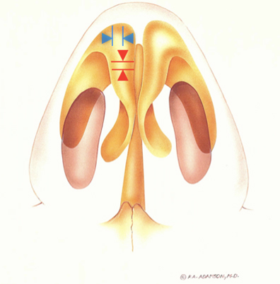 Anatomy of the M-Arch:  Within the lobule